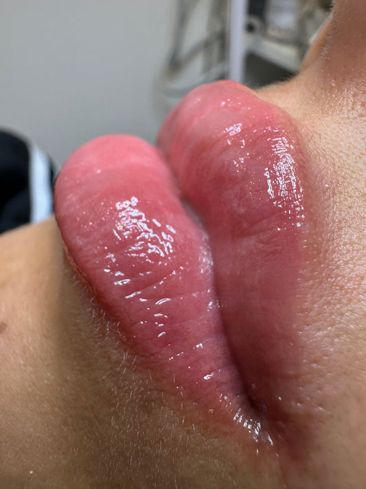 Formación Lips Glow