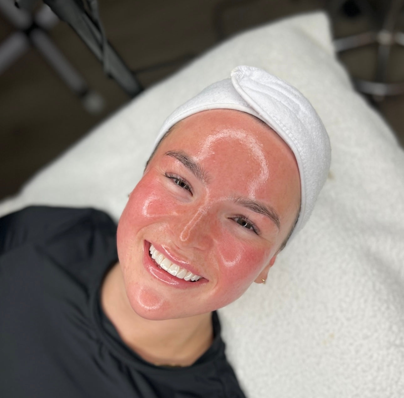 Formación Glass Skin + Hilos Coreanos